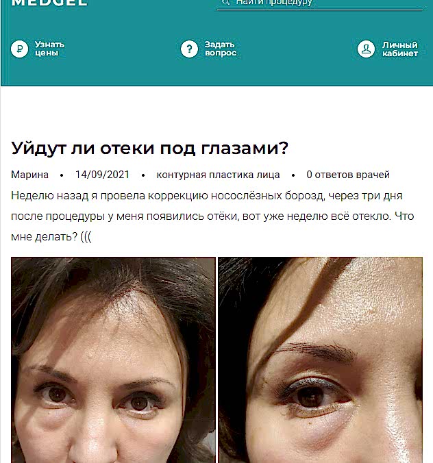 случай отсроченного осложнения из интернет-форума